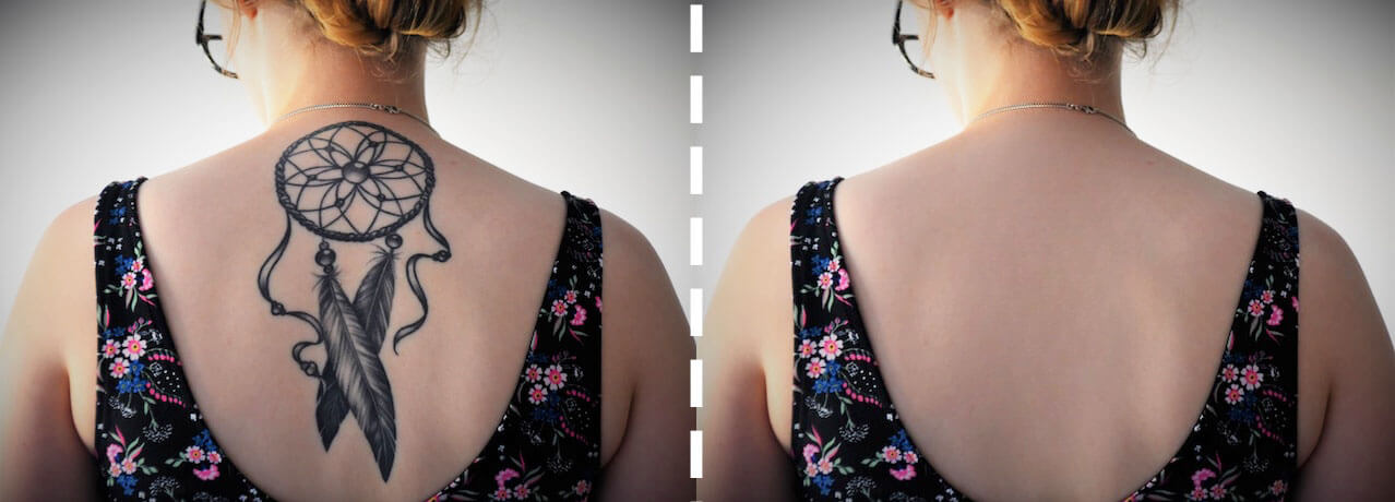 How to remove a tattoo from photo with ease