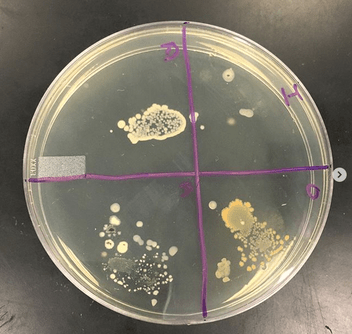 The Big Story The Petri Dish The Biomedical Scientist Magazine Of The Ibms 