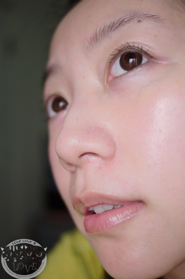 鼻子過敏黑眼圈開刀長期鼻過敏不但會有黑眼圈 還是偏頭痛元兇 醫生分析 這3個 Rjhi