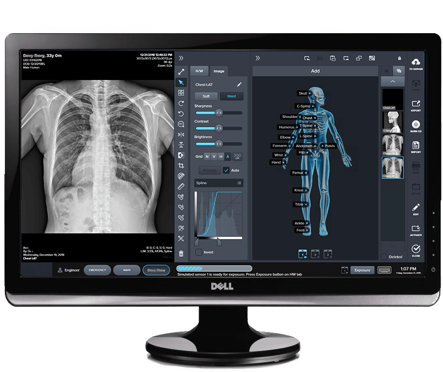 Radiographic Systems - Blue Ridge Imaging Technologies
