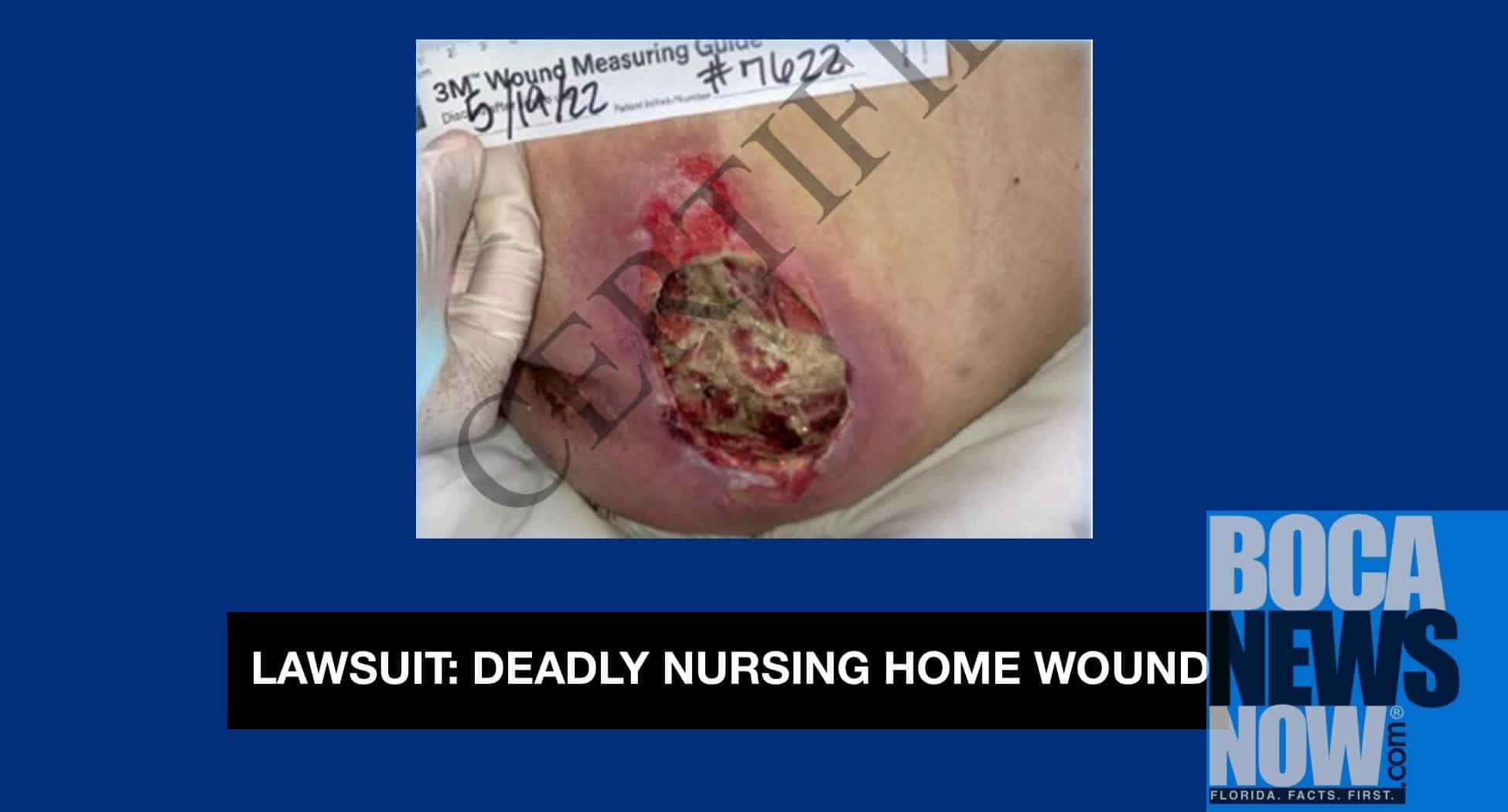 Manor Care Boynton Beach Sued Over Allegedly Fatal Wound - Vimarsana News