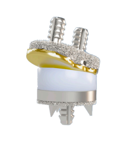 Companies enter joint replacement, spine and trauma segments