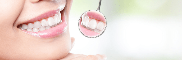 It is important for a person that their dental. How To Get Cheapest Dental Implants In The World Prices Under 500