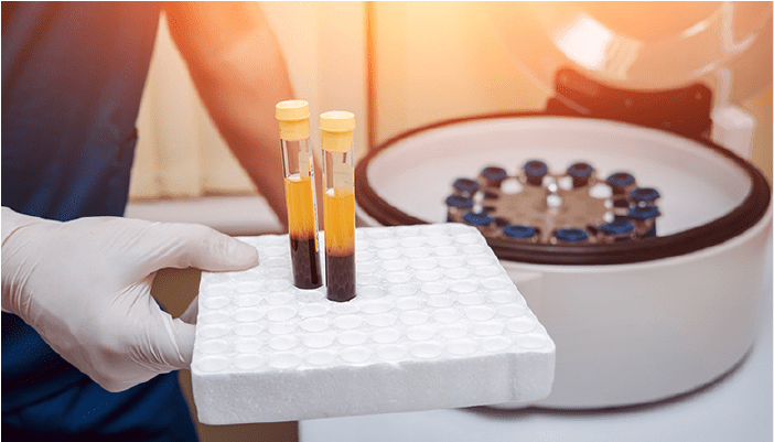 Borges Lab Bottom Up Glycomics - Best Nature Pictures in Retina