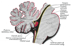 Hydrocephalus After Epilepsy Surgery • The Brain Recovery ... Hydrocephalus After Epilepsy Surgery • The Brain Recovery ...