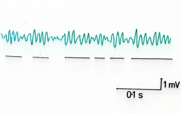 OMT Normal Signal Inverted