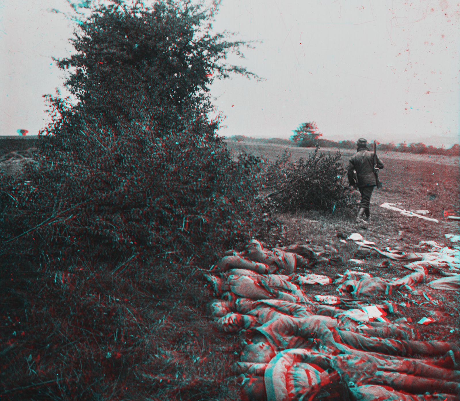 87