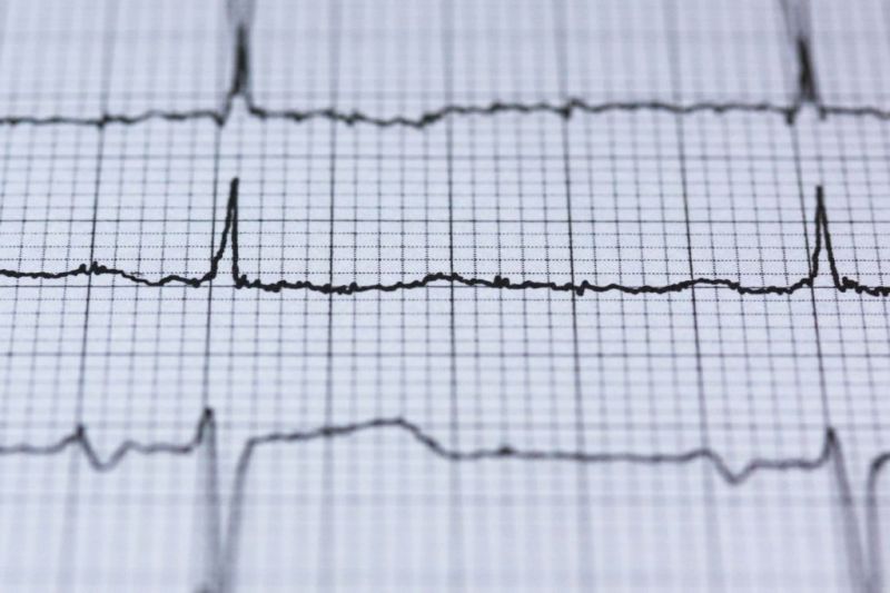 Acls Heartcode Kickstartcpr - Premium Dark Texture Gallery - 8K