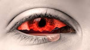 Okay, seriously, can you sunburn your eyeballs looking at the eclipse? Tears Eye drop Buckrail - Jackson Hole, news