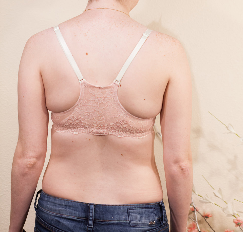 Before (34A)