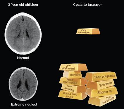 brain1