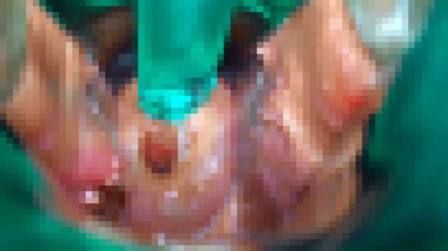 子宮口拡張１　音声あり　～子宮いじめ大好きシリーズ～マニアのための超ドアップ変態映像