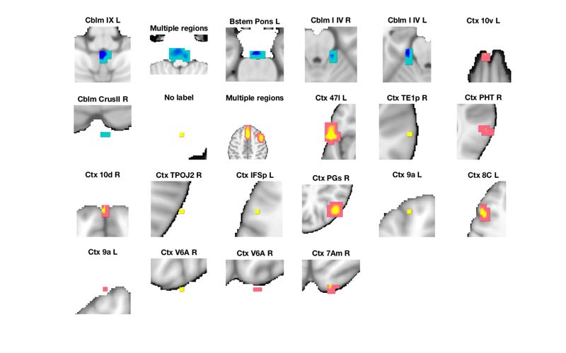 Canlab Help 2b Basic Image Visualization - Premium Geometric Image Gallery - Desktop