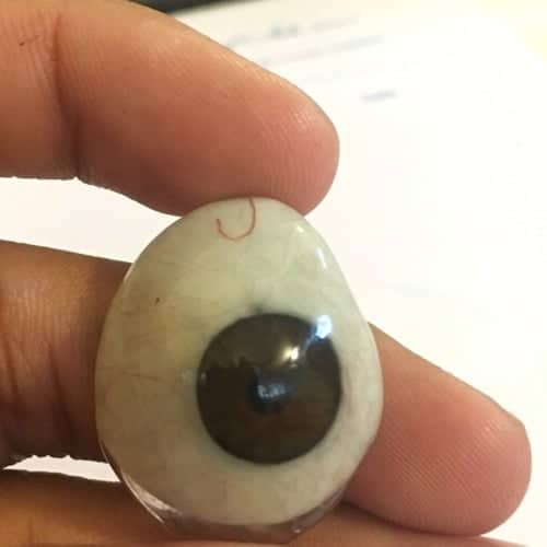 artificial eye