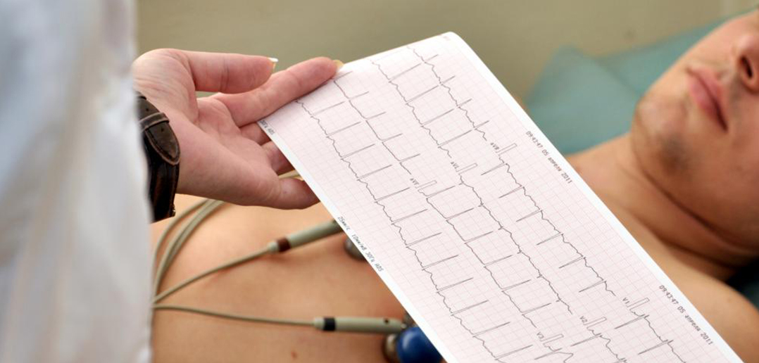 Curso Electrocardiografía Básica – 42 Horas Online