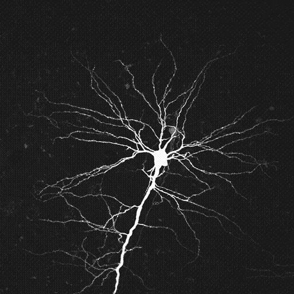 neuron_Branch