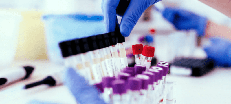 Procedure Coding When To Use The 91 Modifier Continuum - Incredible High Resolution Gradient Patterns | Free Download