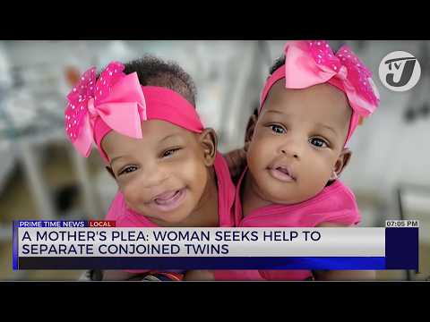 A Mother’s Plea: Woman Seeks help to Separate Conjoined Twins | TVJ News