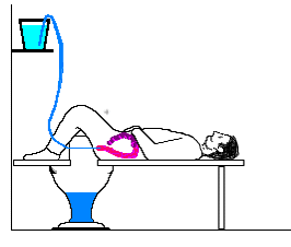 Colonic