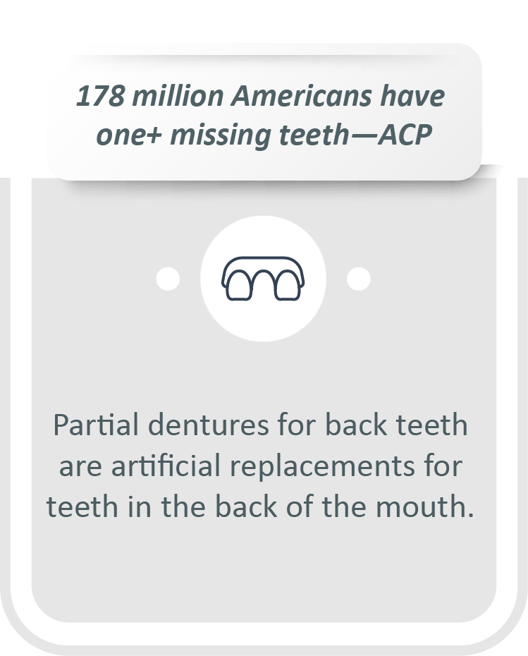 Partial dentures for back teeth infographic: Partial dentures for back teeth are artificial replacements for teeth in the back of the mouth.