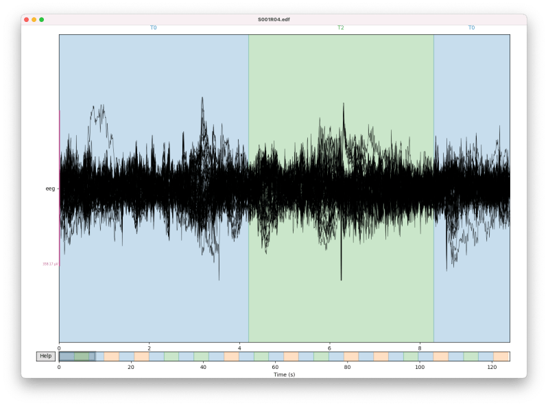 Github Butterbutterflies Dmd Eeg Simple Script Dynamic Mode - Beautiful Nature Photo - HD
