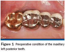 Simplifying The Cementation Protocol Kerr University Online Learning - HD Space Pictures for Desktop