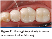 Simplifying Cementation - Best Ocean Backgrounds in HD