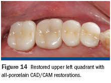 Simplifying The Cementation Protocol Kerr University Online Learning - Creative 8K Landscape Textures | Free Download
