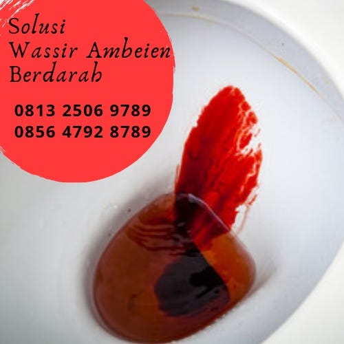 Belanja online obat bab berdarah anak anak terbaik, terlengkap & harga termurah di lazada indonesia | bisa cod ✓ gratis ongkir ✓ voucher diskon. Cara Mengobati Ambeien Berdarah Secara Tradisional Salep Penyakit Herpes Kulit