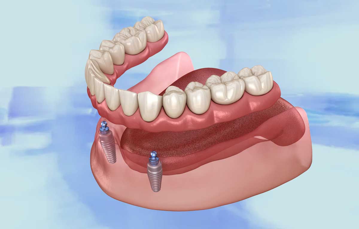 Dentist that repairs dentures near me