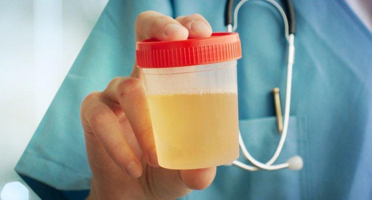 17/10/2012 · memasak dengan proses perubahan dari air ke goreng sebagai cair evaporates. Bingung Membedakan Cairan Ketuban Dan Urine Begini Cara Mudahnya