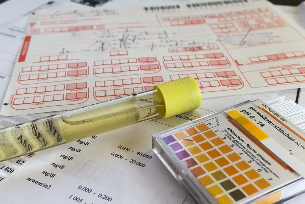 Pemeriksaan garpu tala metode weber. Tes Urine Urinalisis Berbagai Macam Jenis Dan Fungsinya