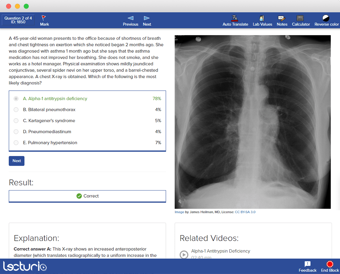 {{ versions.silk }} media player: Usmle Step 1 Qbank Incl Free Practice Questions Lecturio Com