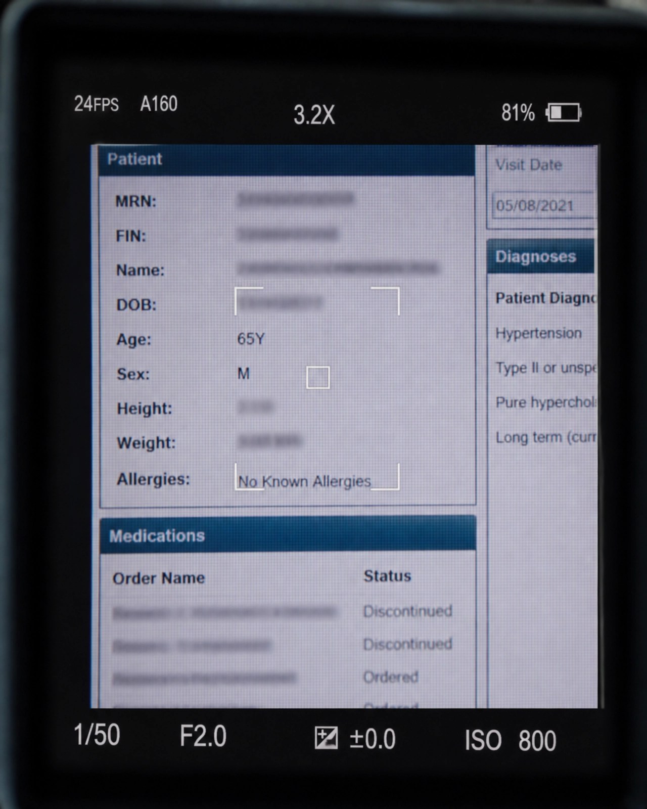 Close-up through a digital lens showing a blurred medical screen representing PHI capture