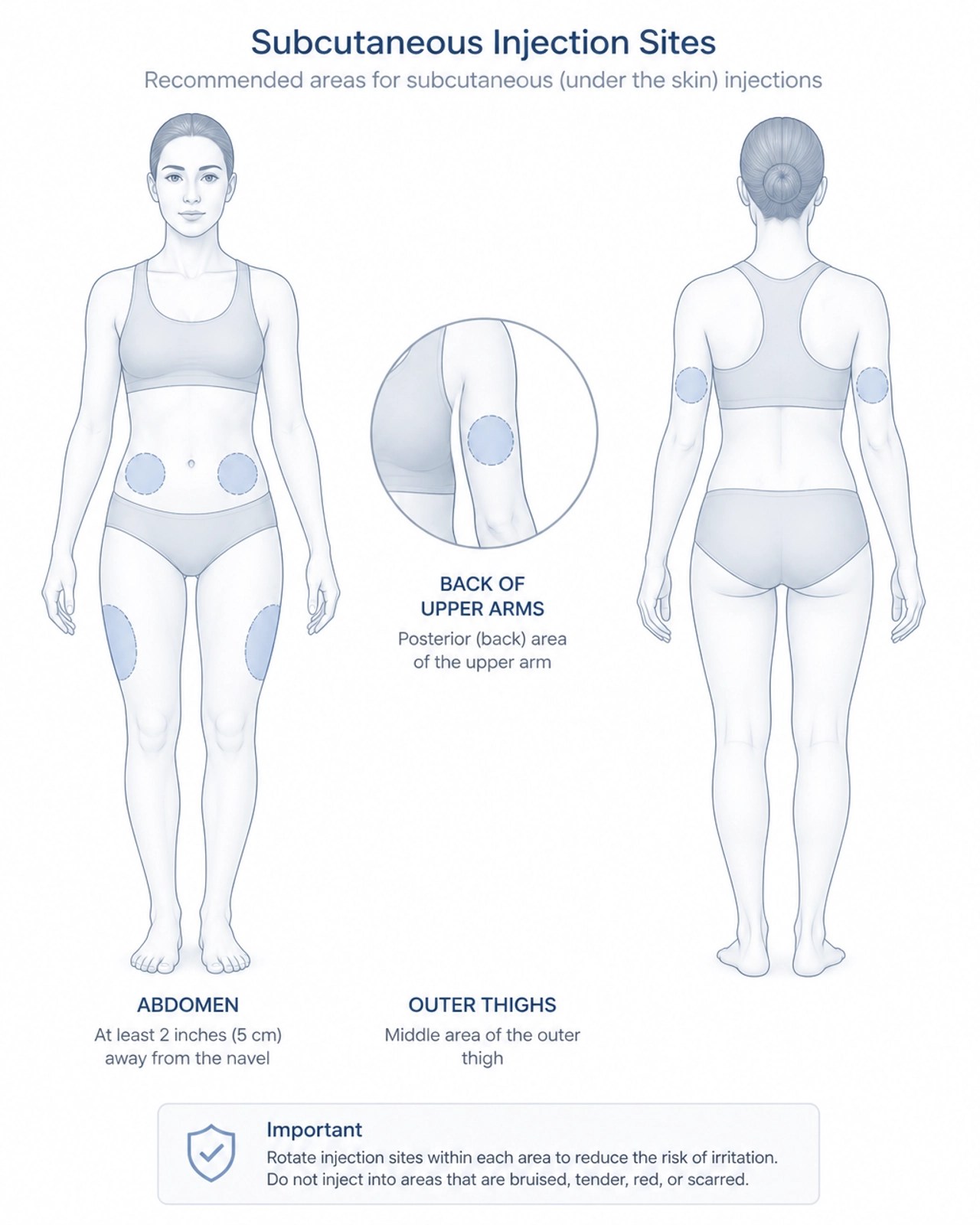 Injection Sites Diagram