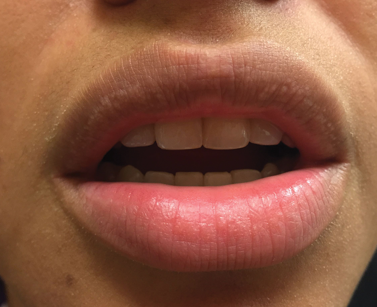 Spots On The Tongue Black Red White Or Grey