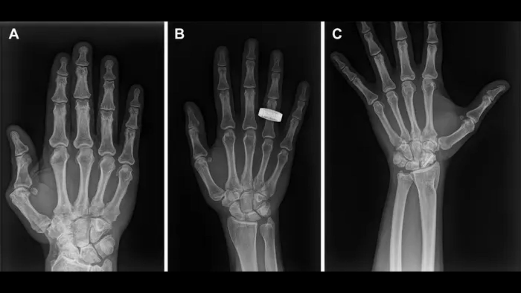 Revolutionary X-Ray Technology: Enabling Medical Care in Space and Rural Earth (2026)