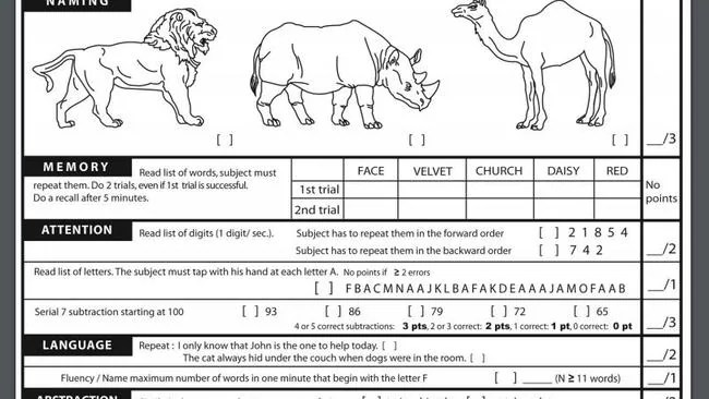 A quick screen for mild cognitive dysfunction. Take the Montreal Cognitive Assessment that Trump took