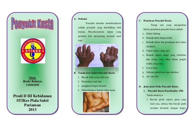 Pengertian Penyakit Kusta Dalam Dunia Medis