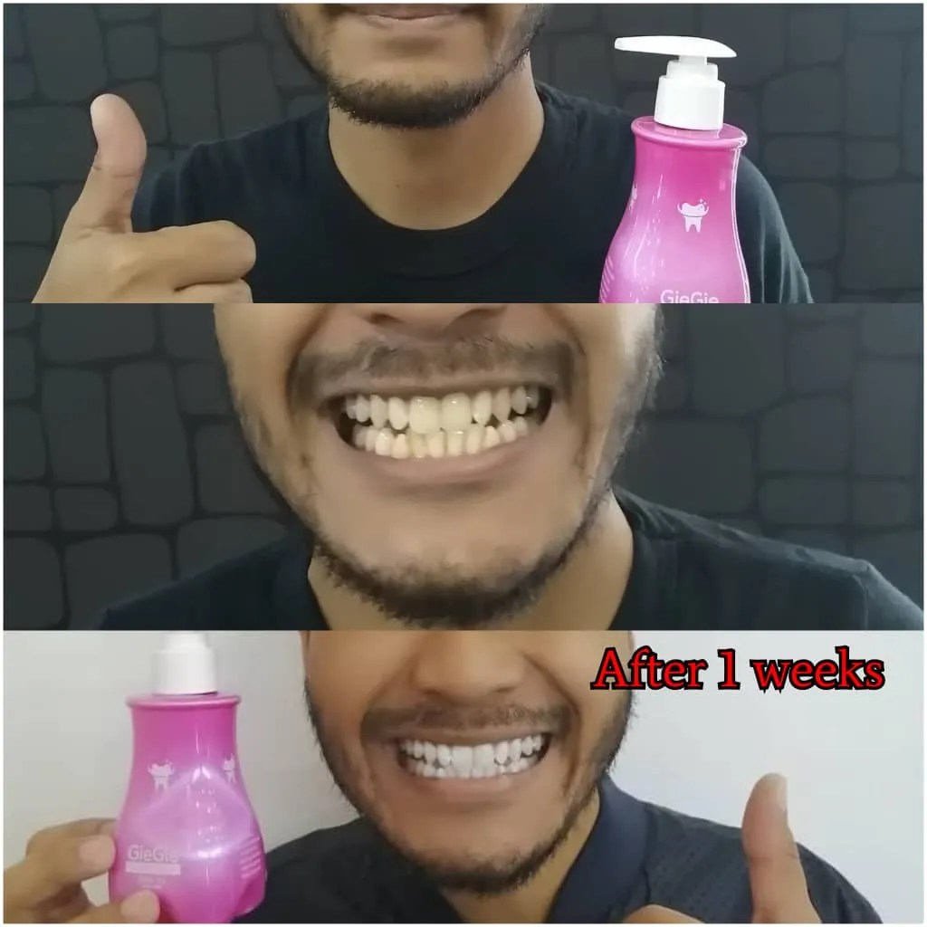 Colgate toothpaste was sold in glass jars since 1873. Ubat Gigi Perokok - Opening x