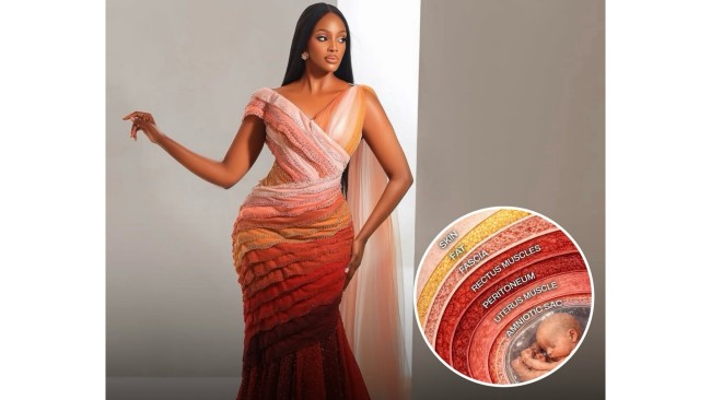 Gaun Miss Uganda di Miss World 2026 Ubah Tujuh Lapisan Operasi Caesar Jadi Karya Couture