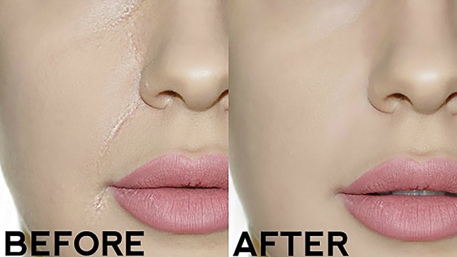 Smile Line Sering Crack setelah Makeup? Teknik Ini Bisa Dicoba Tanpa Tambah Produk