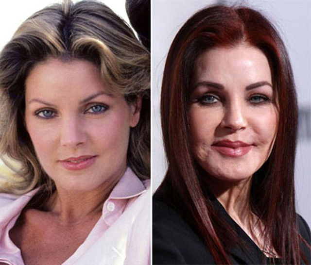 15 eye catching celebs destroyed by plastic surgery | allinall. Priscilla Presley Facelift Plastic Surgery Before and
