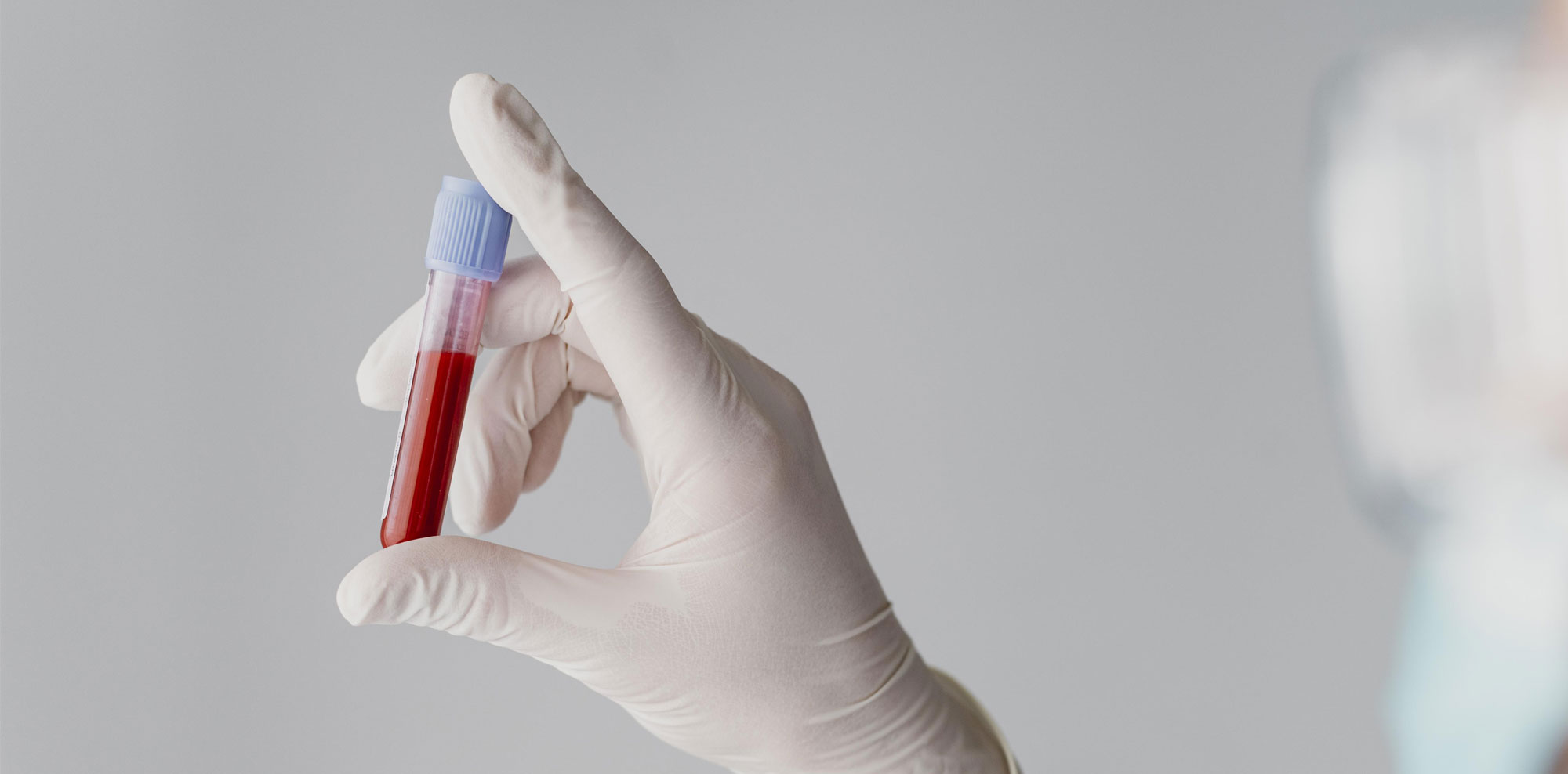 Lee más sobre el artículo Análisis de sangre