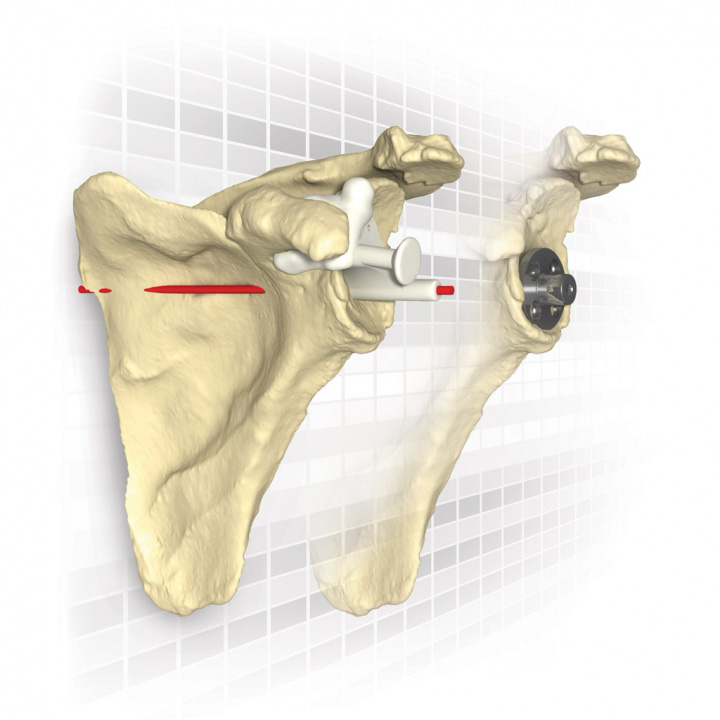 Match Point - Gradient Art Collection - Full HD Quality