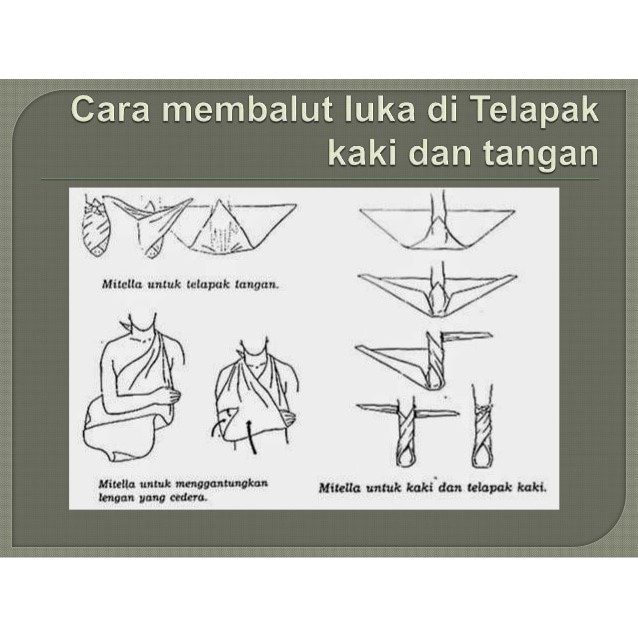 Perlu untuk kita ketahui, kalo cedera sekecil apa pun yang dialami, jangan pernah kita abaikan. Mitela Bh Kain Mitela Kain Pembalut Bidai Mitela Pmr Shopee Indonesia