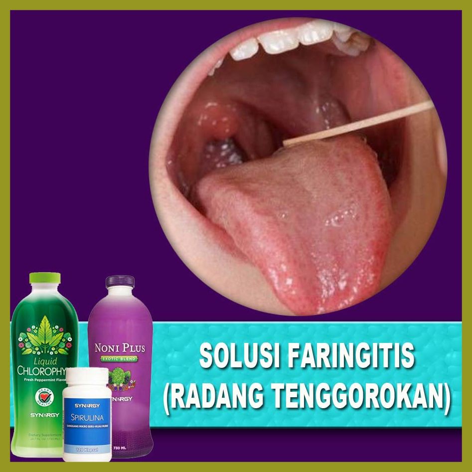 100 Ori Ramuan Herbal Obat Radang Tenggorokan Faringitis Synergy