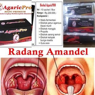 Obat Herbal Radang Amandel Untuk Anak Dan Dewasa Ampuh Aman Tanpa