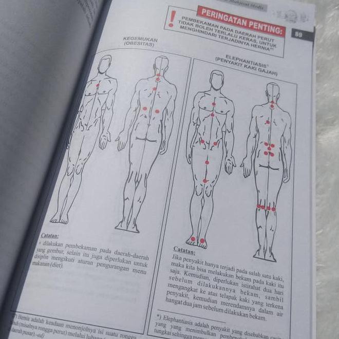 Daerah punggung (di bawah tulang belikat), bekam di daerah ini. Buku Bekam Sunnah Nabi Mukjizat Medis Shopee Indonesia