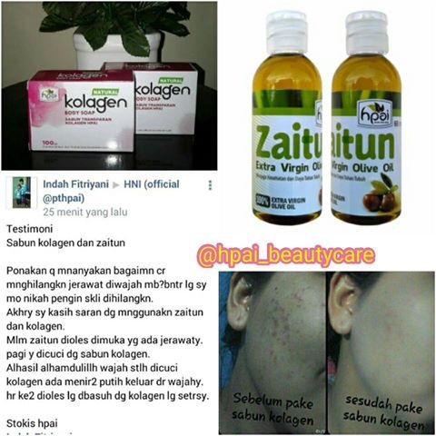 Minyak herba sinergi hpai untuk wajah di tokopedia ∙ promo pengguna baru ∙ cicilan 0% ∙ kurir instan. Testimoni Jerawat Hioang Pake Produk Hni Hpai